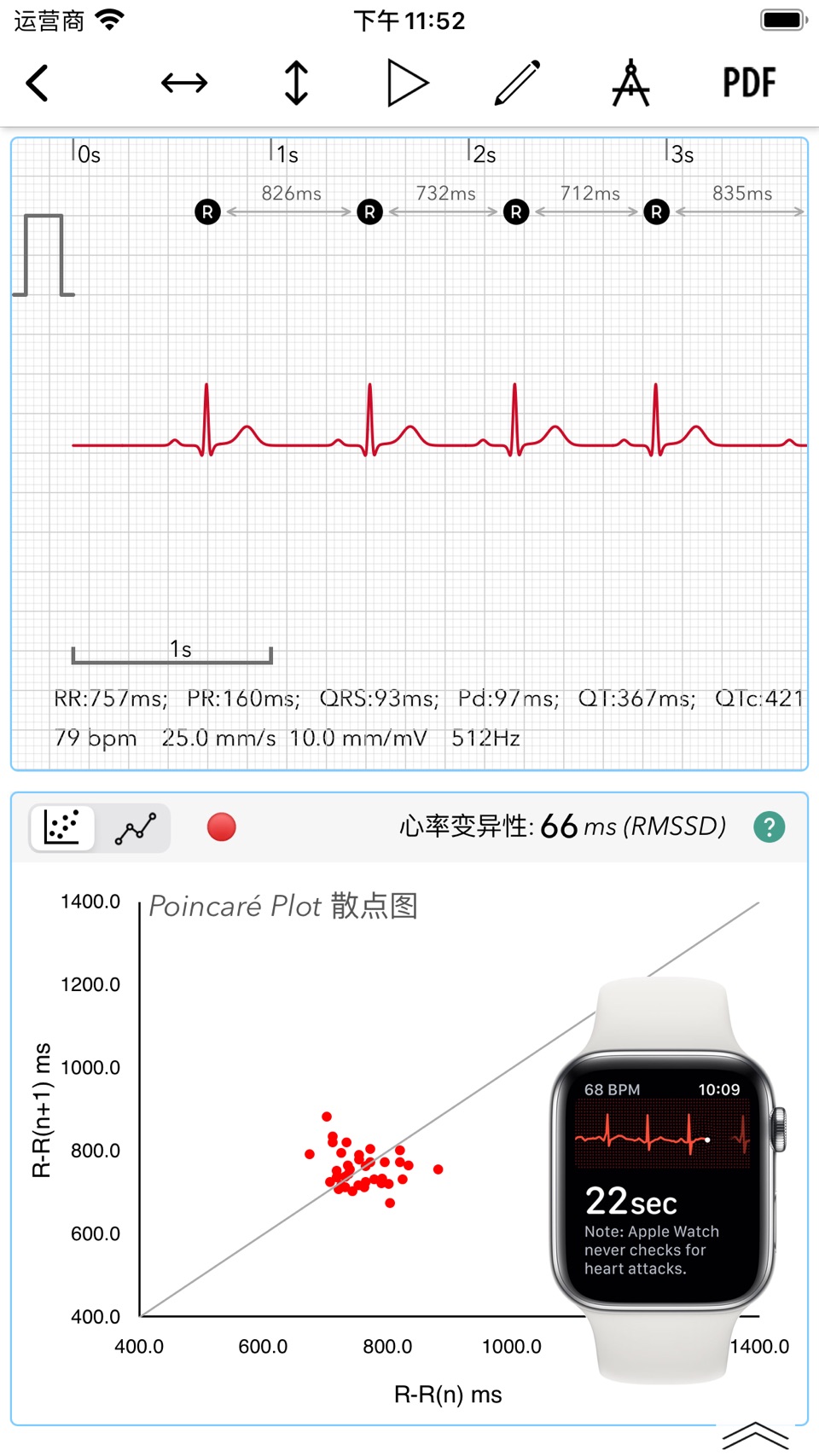 ECG+ | 解读你的 Watch ECG 心电图报告 · Store screenshots
